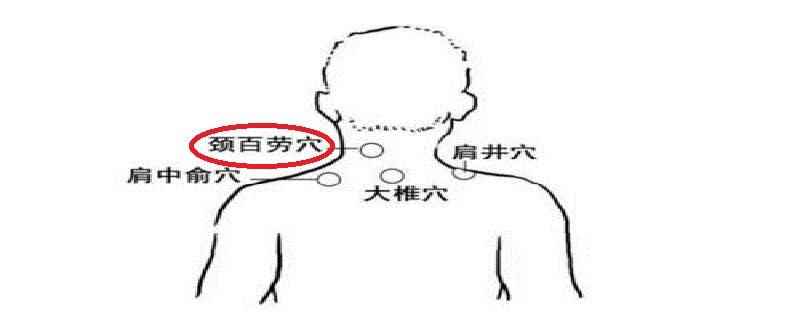 颈百劳在什么位置图(颈百劳在什么位置)