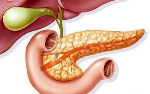 怎么会得急性胰腺炎(轻症急性胰腺