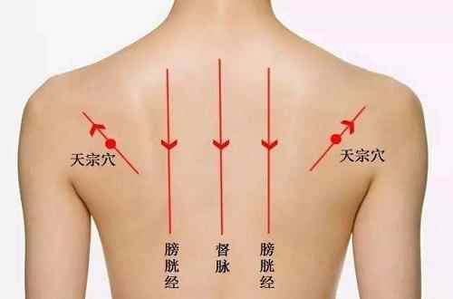 拔罐后背的位置示意图(天宗穴理气消肿归经:手太阳小肠经)