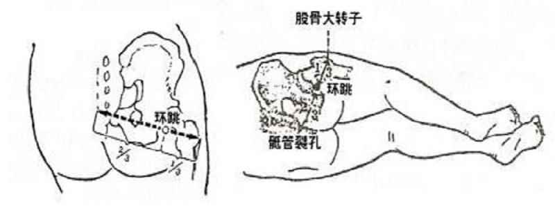 环跳的准确位置图视频(环跳的正确按摩方法用拇指稍微用力按摩穴位)