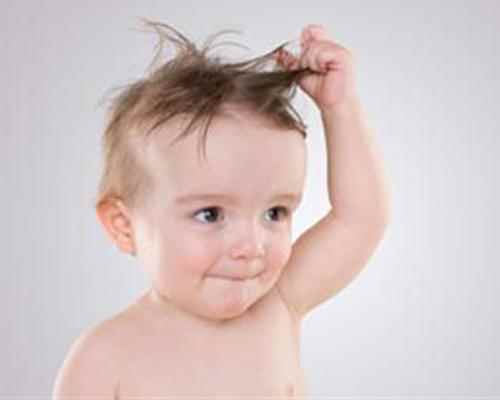 宝宝头上的头垢是湿疹吗(宝宝头上的是头垢还是湿疹)