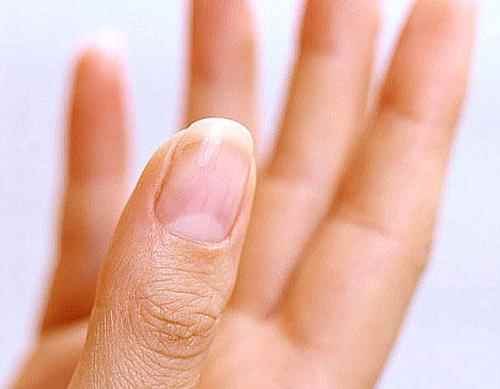 指甲上只有大拇指有月牙代表什么(