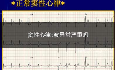 窦性心律t波异常严重吗(窦性心律T波异常是指心电图上的一个表现)