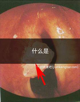 什么是 BMI(体质指数、体重指数)(BMI是与体内脂肪总量密切相关的指标)