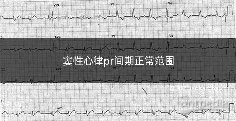 窦性心律pr间期正常范围(窦性心律PR间期正常范围)