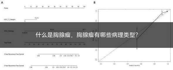 什么是胸腺瘤(什么是胸腺瘤症状)