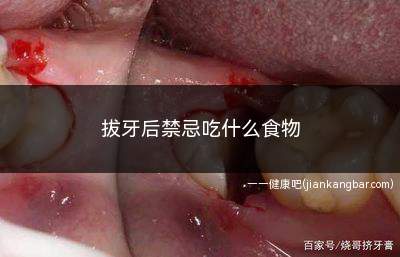 拔牙后禁忌吃什么食物(辛辣刺激的食物有哪些)