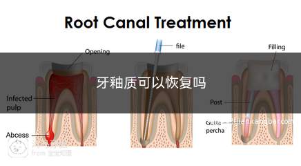 牙釉质可以恢复吗(牙釉质损坏了怎样恢复)