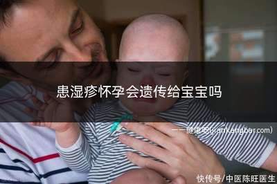 患湿疹怀孕会遗传给宝宝吗(哪些准妈妈容易患湿疹过敏体质的孕妇)