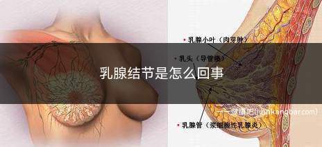 乳腺结节是怎么回事(乳腺结节是怎么回事需要怎么治疗)