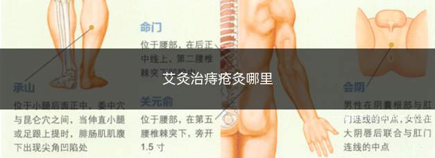 艾灸治痔疮灸哪里(艾灸治痔疮取穴主要有以下一些穴位)