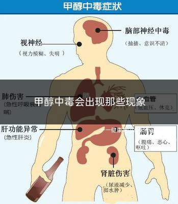 甲醇中毒会出现那些现象(中枢神经症状甲醇中毒后会对人体的神经组织造成严重伤害)