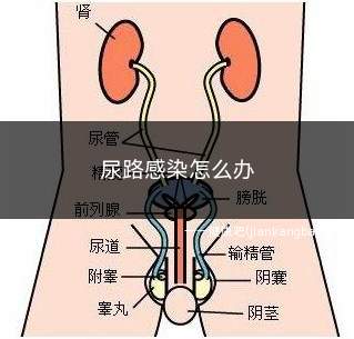 尿路感染怎么办(尿路感染的治疗原则是控制症状、消灭病原体、去除诱发因素及防止)