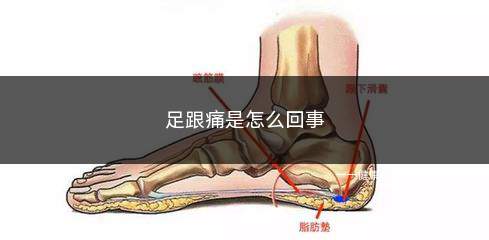 足跟痛是怎么回事(足跟痛是怎么回事吃什么药比较好)