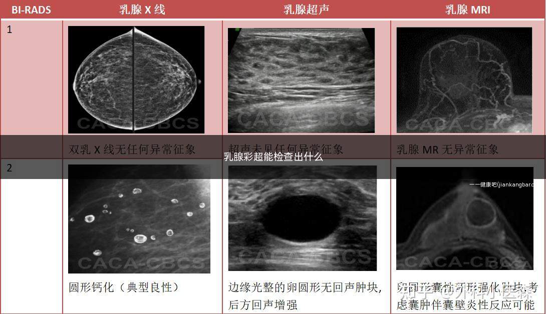 乳腺彩超能检查出什么(乳腺彩超能检查出什么来)